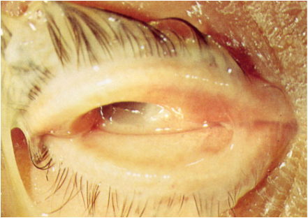 acuta