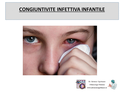 Retinopatia del prematuro (ROP) - Malattia vascolare della retina nei neonati pretermine