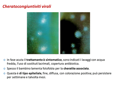 Retinopatia del prematuro (ROP) - Malattia vascolare della retina nei neonati pretermine