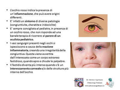 Retinopatia del prematuro (ROP) - Malattia vascolare della retina nei neonati pretermine