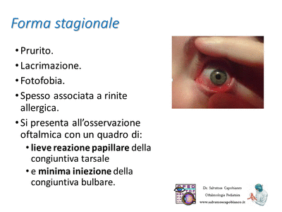 Retinopatia del prematuro (ROP) - Malattia vascolare della retina nei neonati pretermine