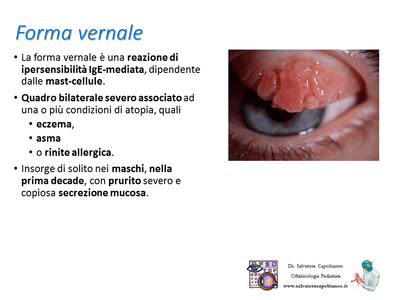 Retinopatia del prematuro (ROP) - Malattia vascolare della retina nei neonati pretermine