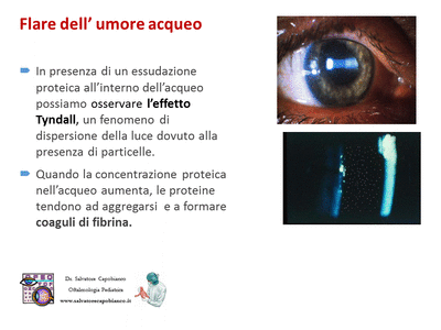 Retinopatia del prematuro (ROP) - Malattia vascolare della retina nei neonati pretermine