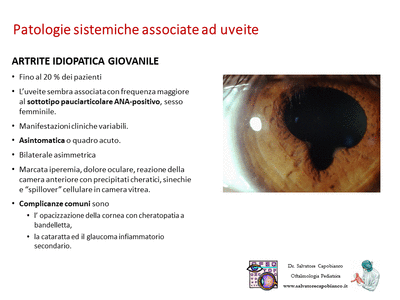 Retinopatia del prematuro (ROP) - Malattia vascolare della retina nei neonati pretermine