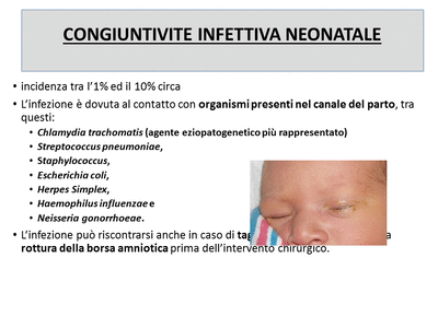 Retinopatia del prematuro (ROP) - Malattia vascolare della retina nei neonati pretermine