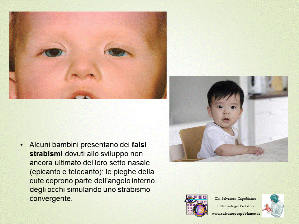 Domande frequenti - Risposte sulla prescrizione di lenti ai bambini