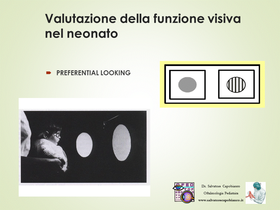 Montature pediatriche - Caratteristiche e consigli pratici