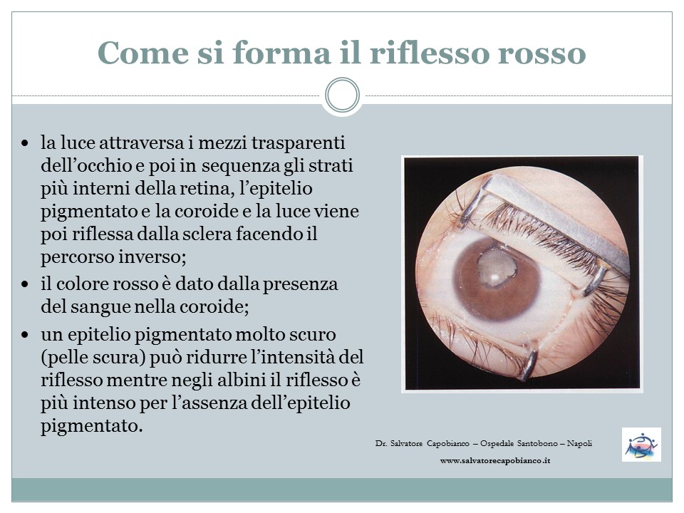 Prevenzione oculistica bambini - Screening età pediatrica