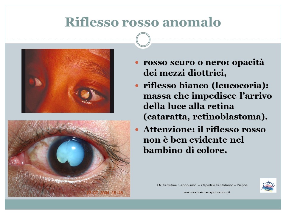 Visita oculistica preventiva - Salute visiva pediatrica