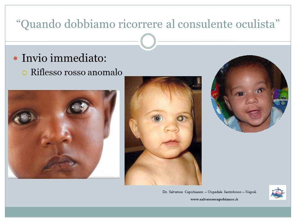 Controllo vista bambini - Prevenzione problemi visivi