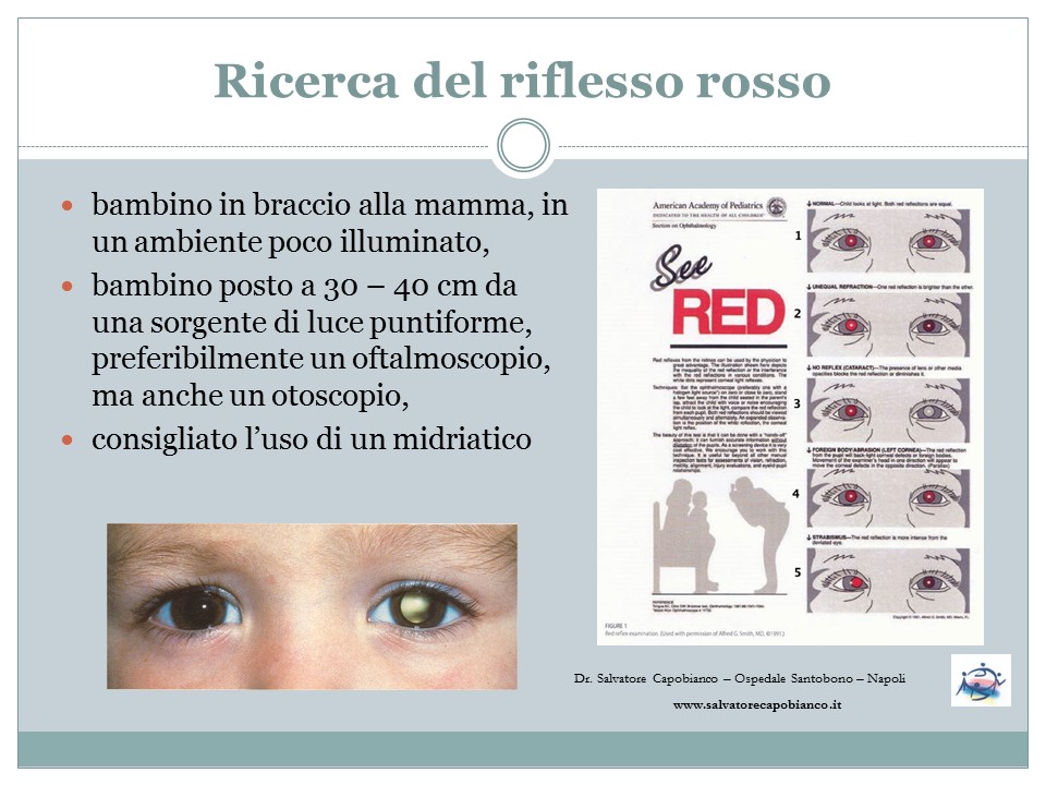 Esame oculistico pediatrico - Valutazione funzionalità visiva