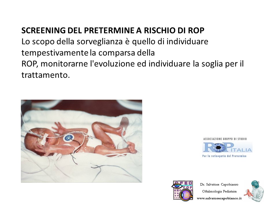 Retinopatia del prematuro (ROP) - Malattia vascolare della retina nei neonati pretermine