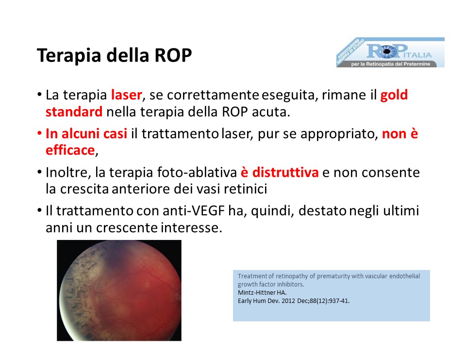 Retinopatia del prematuro (ROP) - Malattia vascolare della retina nei neonati pretermine