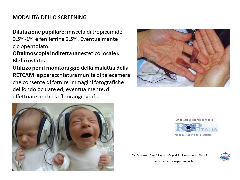 Retinopatia del prematuro (ROP) - Malattia vascolare della retina nei neonati pretermine