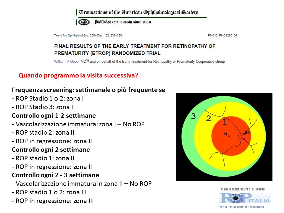 Retinopatia del prematuro (ROP) - Malattia vascolare della retina nei neonati pretermine