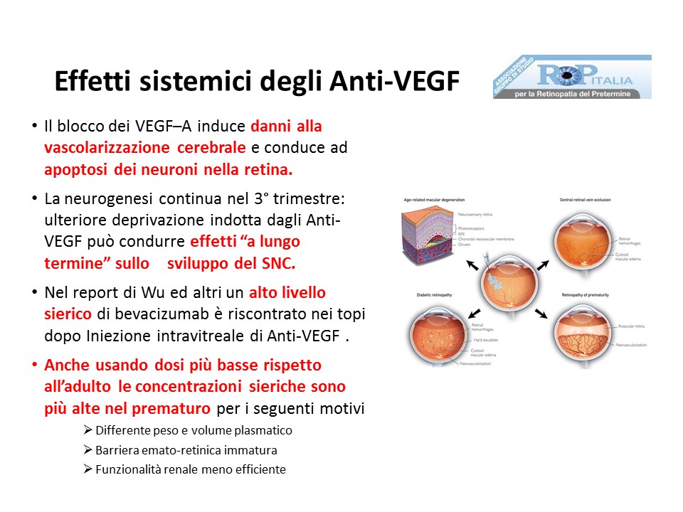 Retinopatia del prematuro (ROP) - Malattia vascolare della retina nei neonati pretermine