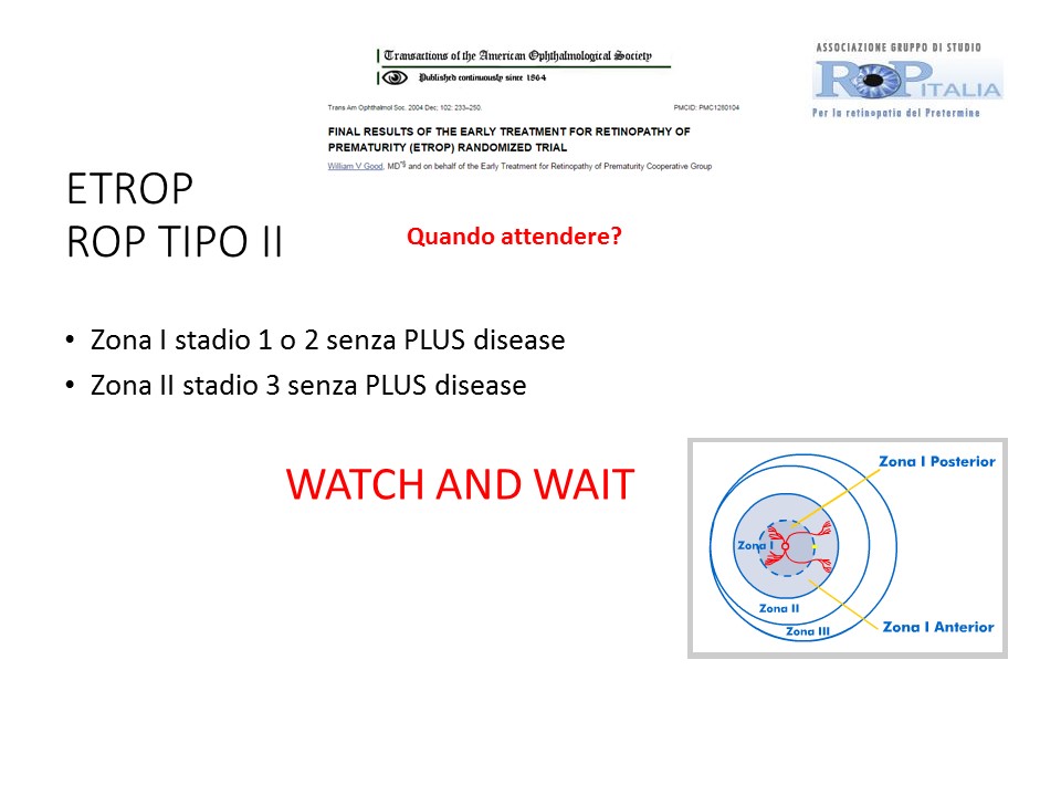 Retinopatia del prematuro (ROP) - Malattia vascolare della retina nei neonati pretermine