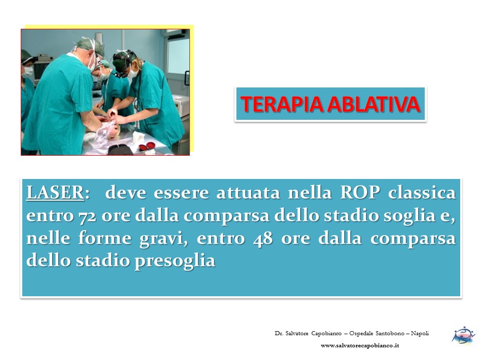 Retinopatia del prematuro (ROP) - Malattia vascolare della retina nei neonati pretermine