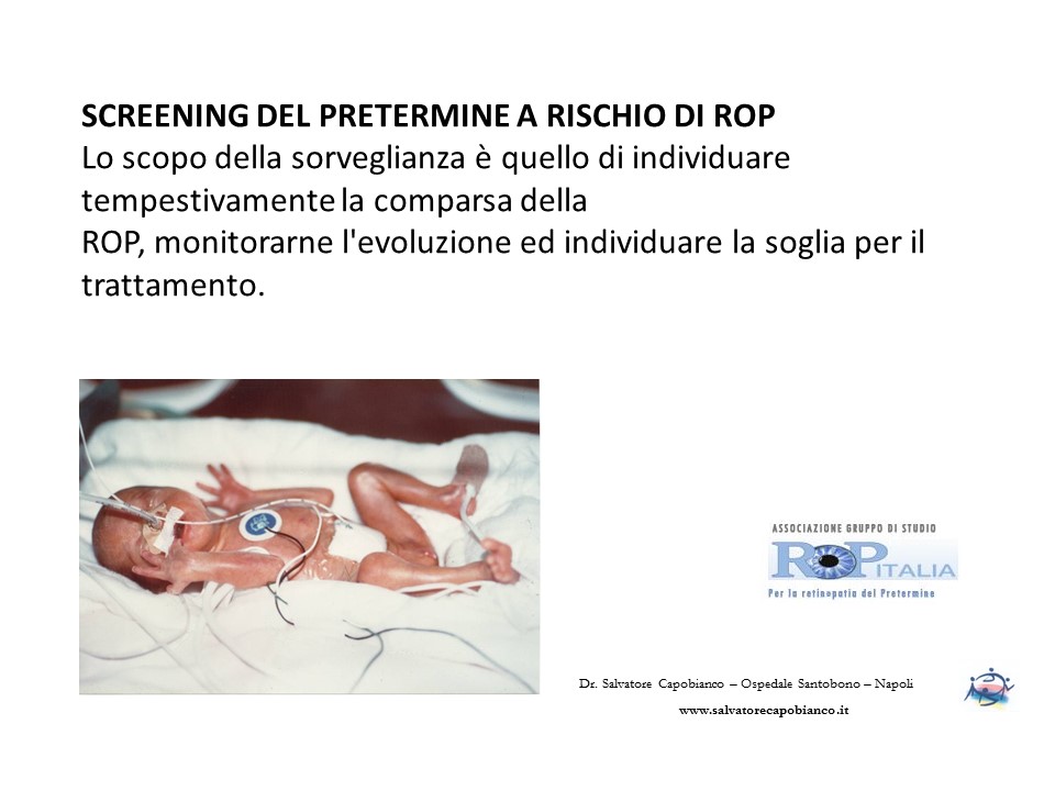 Retinopatia del prematuro (ROP) - Malattia vascolare della retina nei neonati pretermine
