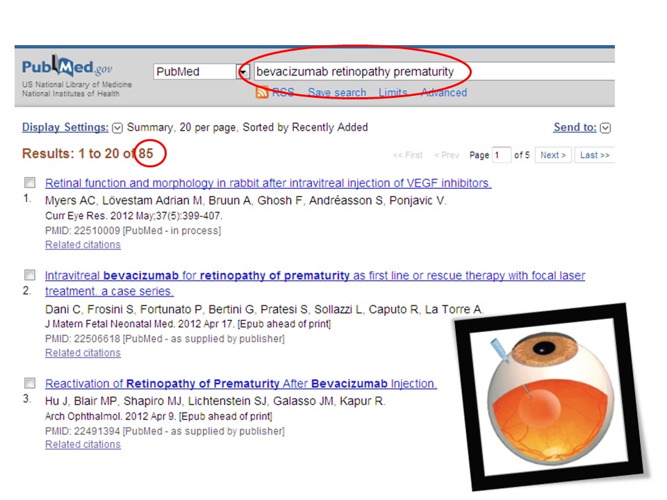 Retinopatia del prematuro (ROP) - Malattia vascolare della retina nei neonati pretermine