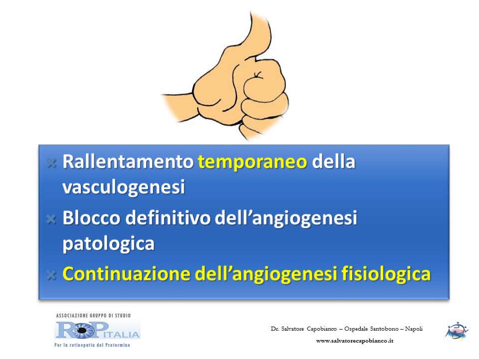 Retinopatia del prematuro (ROP) - Malattia vascolare della retina nei neonati pretermine